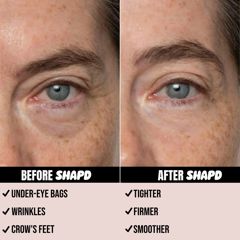 SHAPD Eye Bag Instant Eraser